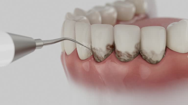 Trusted Teeth Cleaning And Checkup service in Cottage Grove, WI - Dentist Open Now